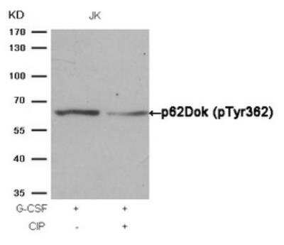 Western Blot: DOK1 [p Tyr362] Antibody [NB100-82112] - Analysis of extracts from JK cells.